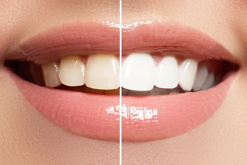 Trio Dentistry | 3163 Winston Churchill Blvd, Mississauga, ON L5L 2W1, Canada | Phone: (905) 812-1818