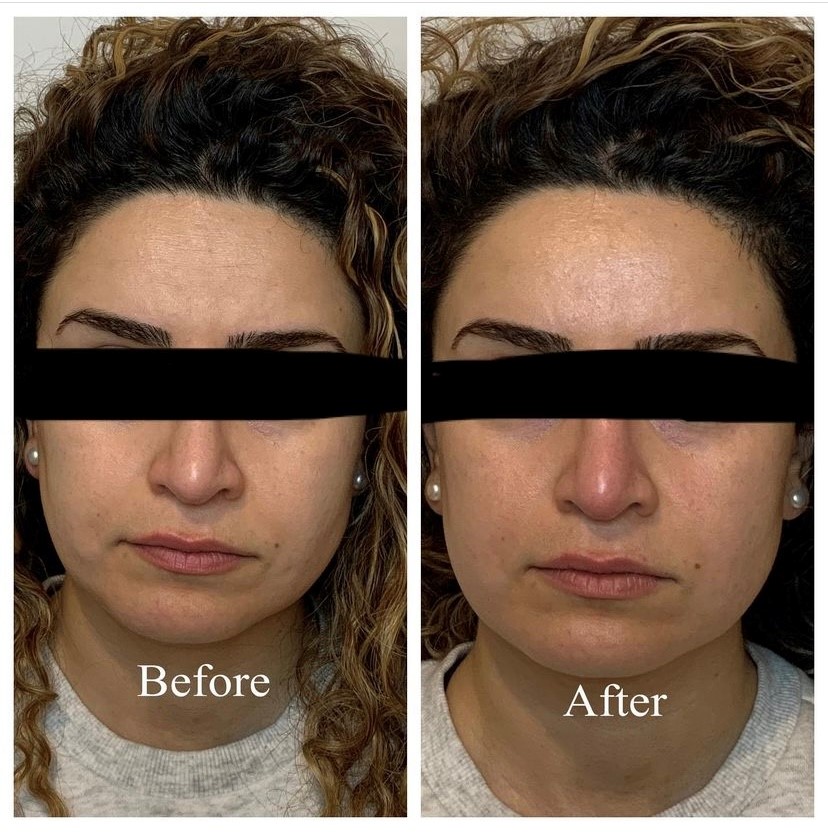 Fredas Rejuvenation Clinic | 4523 Kelly Farm Dr, Ottawa, ON K1X 0E7, Canada | Phone: (613) 324-8978