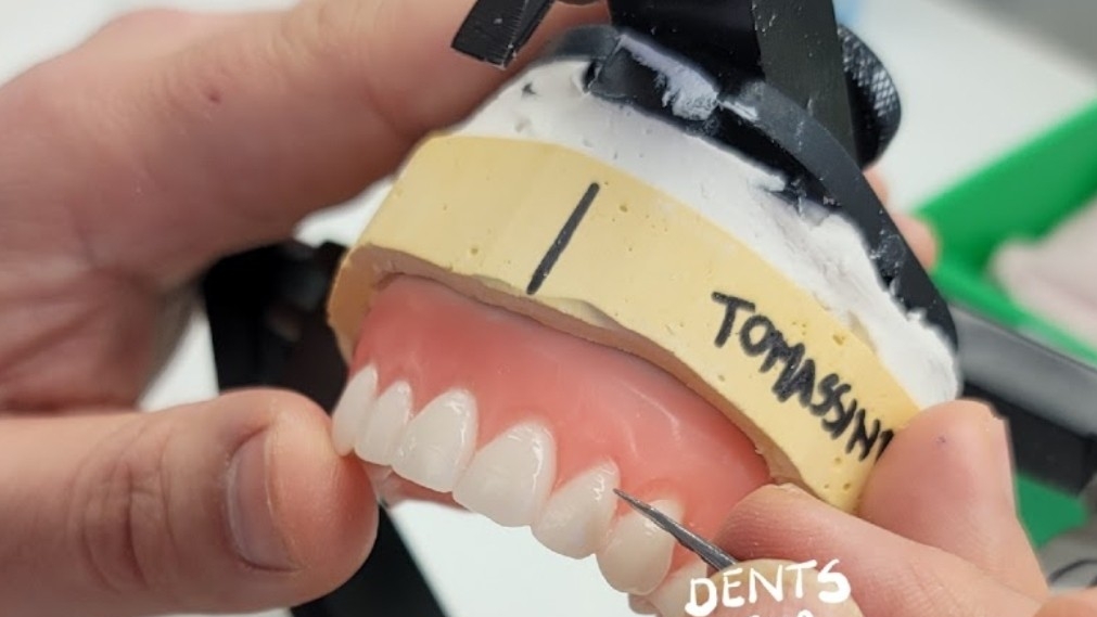 Denturologiste Rivière Rouge | 716 Rue LAnnonciation N Suite 202, Rivière-Rouge, QC J0T 1T0, Canada | Phone: (819) 275-2418