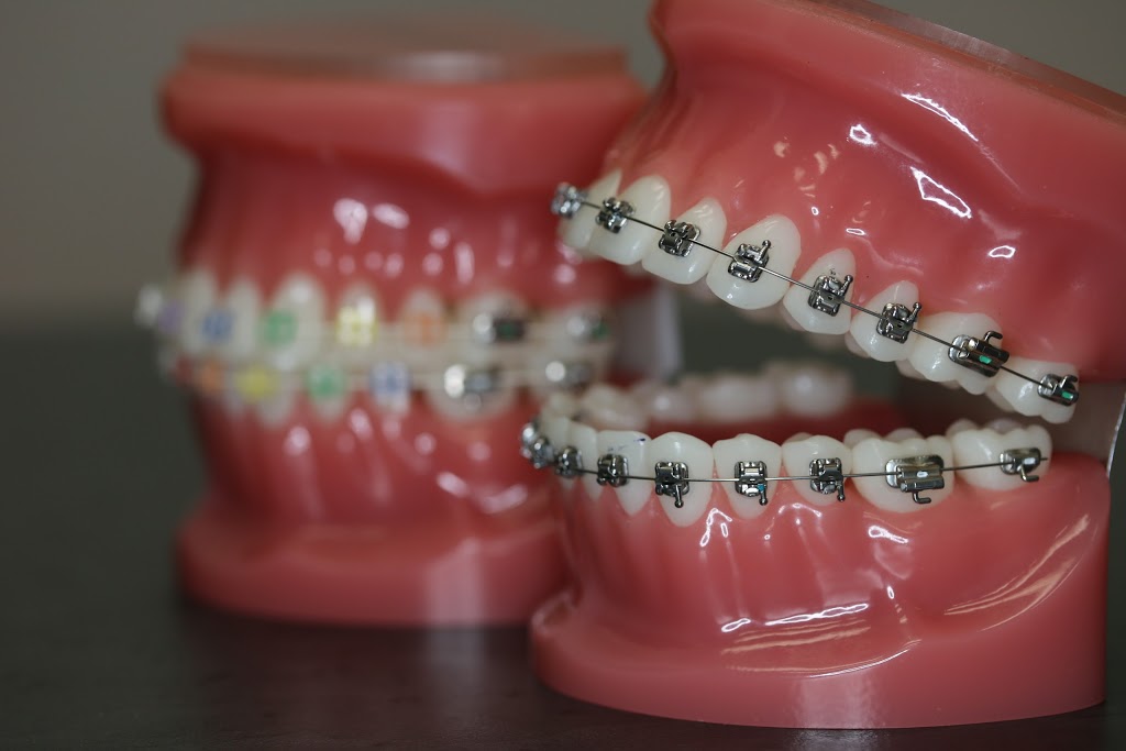 Morpho Orthodontics - Dr. Kresimir Lackovic | 925 Rathburn Rd E suite d1, Mississauga, ON L4W 4C3, Canada | Phone: (905) 276-3999