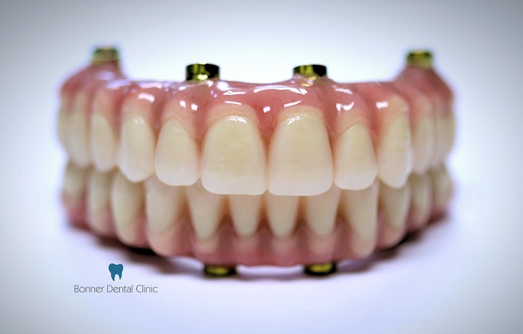 Bonner Dental Clinic | 591 Rothesay Ave, Saint John, NB E2H 2G9, Canada | Phone: (506) 633-1086