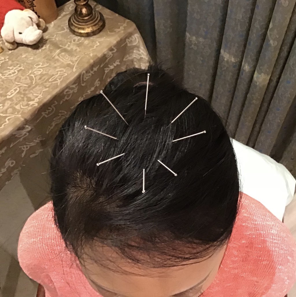 The Herbal Path (Traditional Chinese Medicine & Acupuncture Clin | 2012 Oak Bay Ave, Victoria, BC V8R 1E4, Canada | Phone: (250) 598-8805