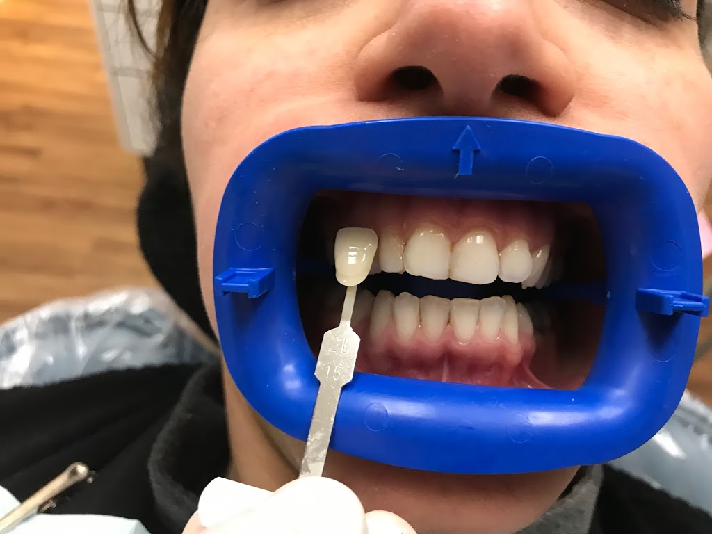 Blue Sky Dental Clinic | 742 Marine Dr, North Vancouver, BC V7M 1H3, Canada | Phone: (604) 971-6999