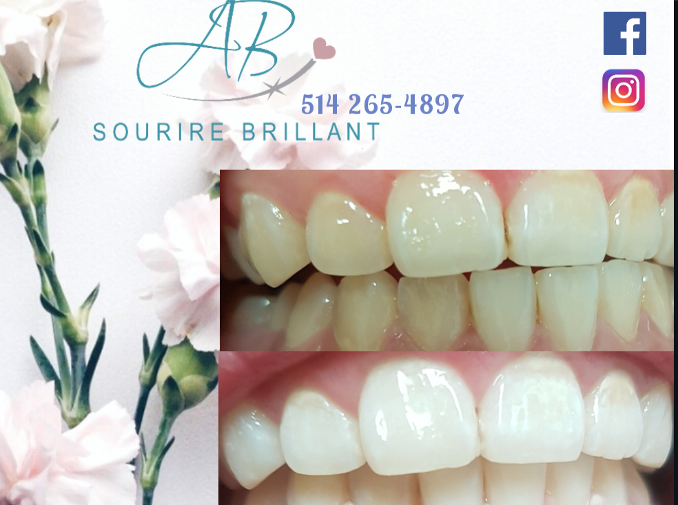 A.B. Sourire Brillant | 4600 Boulevard Sainte-Rose, Laval, QC H7R 1Z2, Canada | Phone: (514) 265-4897