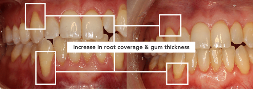 Smile Dental Implant Center - White Rock Dentists & Dental Implants | 1959 152 St, Surrey, BC V4A 9E3, Canada | Phone: (604) 531-3344