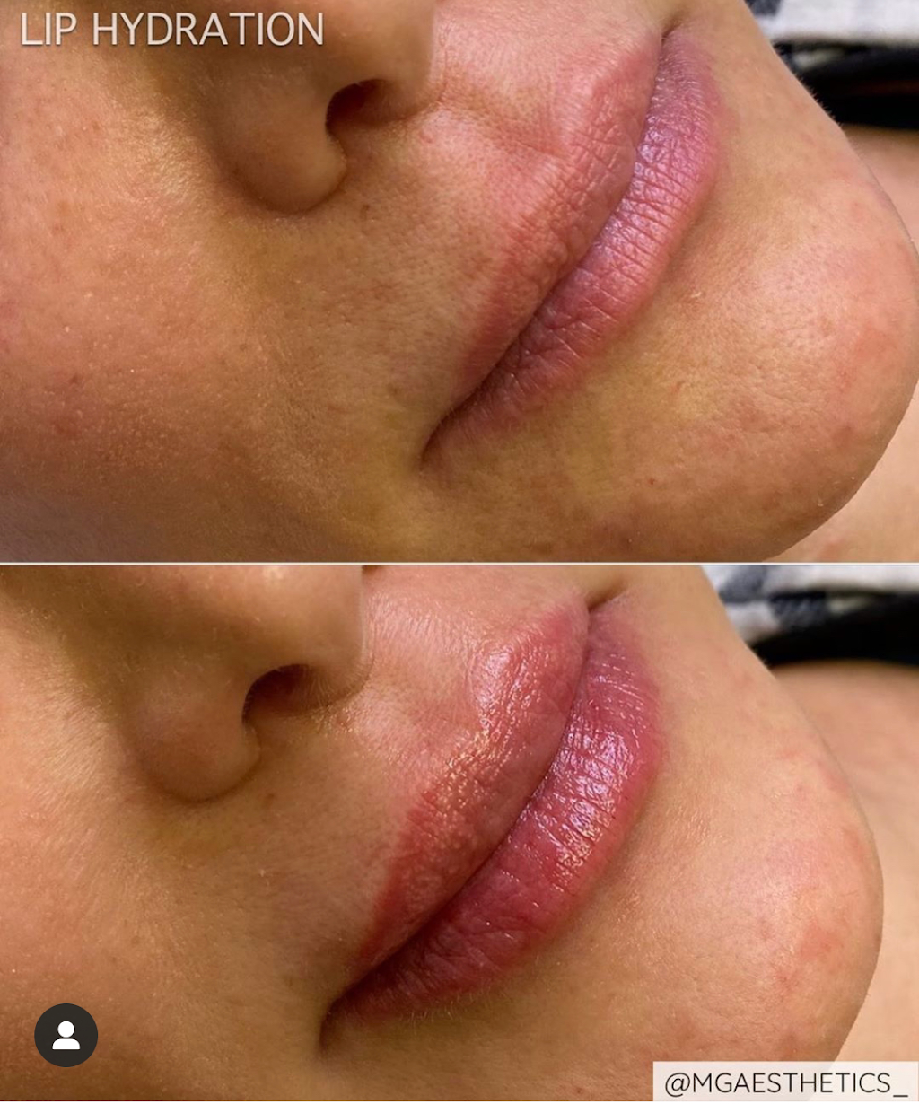 MG AESTHETICS | 10395 Weston Rd, Woodbridge, ON L4H 3T4, Canada | Phone: (289) 380-7774