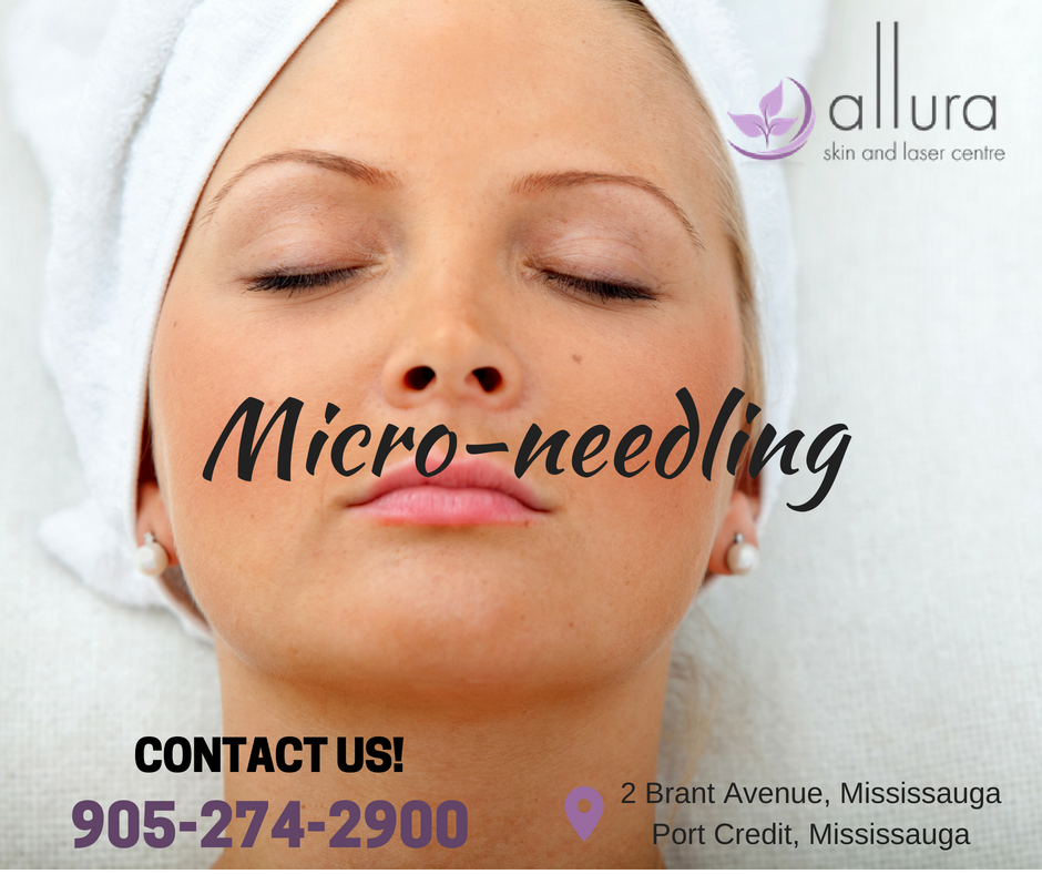Allura Skin & Laser Centre | 2 Brant Ave, Mississauga, ON L5G 3N8, Canada | Phone: (905) 274-2900