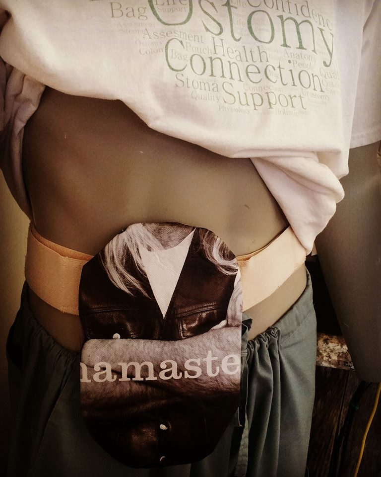 Ostomy Connection | 7 Main St W, Norwich, ON N0J 1P0, Canada | Phone: (519) 200-7031