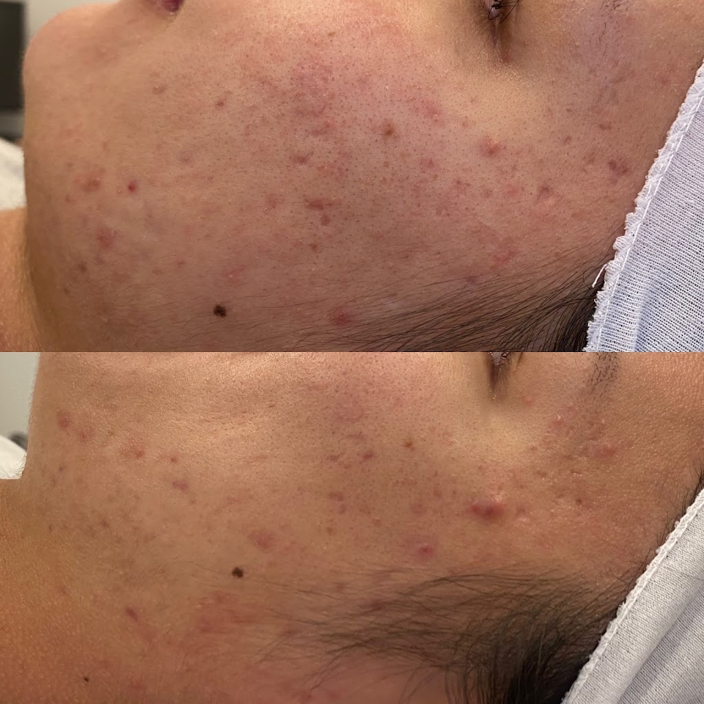 Bare Skin By Teodora | 7008 187 St NW, Edmonton, AB T5T 2W2, Canada | Phone: (780) 297-3242