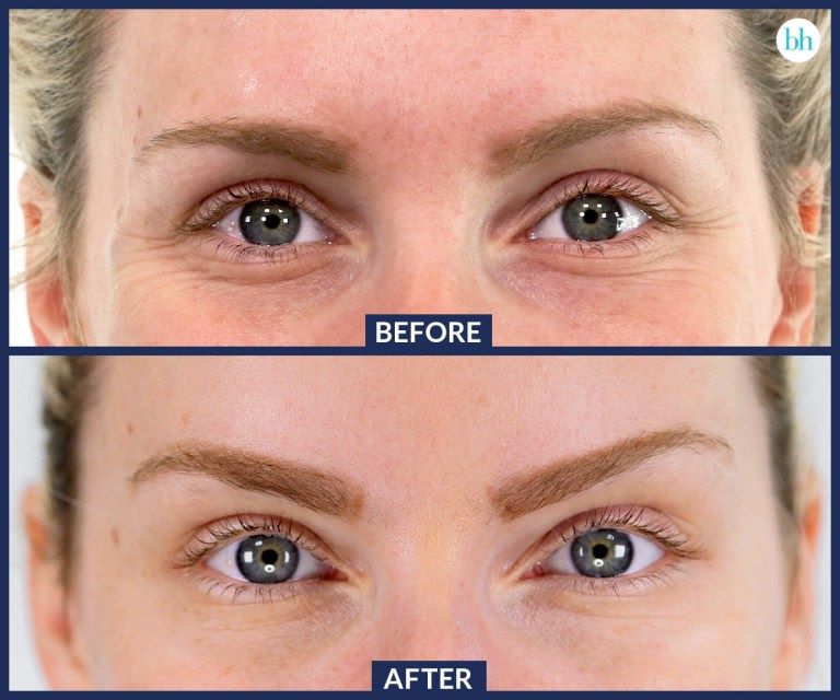 Courtice Cosmetics Botox Clinic | Unit 10 A- 1414 King Street East located inside Townline Pharmacy, Courtice, ON L1E 3B4, Canada | Phone: (905) 666-0757