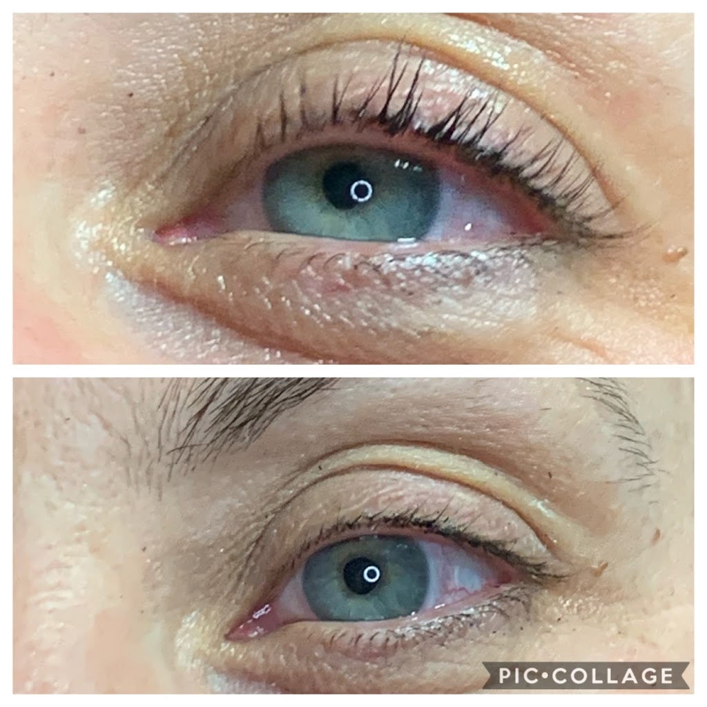 LaserHaven & Beauty | 2480 Strandherd Dr, Nepean, ON K2G 4S4, Canada | Phone: (613) 265-6932