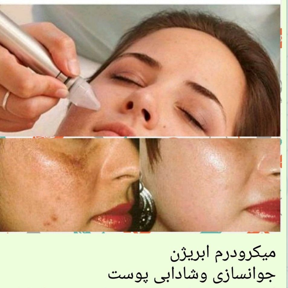 M.B Beauty Laser Clinic & Spa | 545 Speedvale Ave E, Guelph, ON N1E 1P7, Canada | Phone: (416) 838-2736