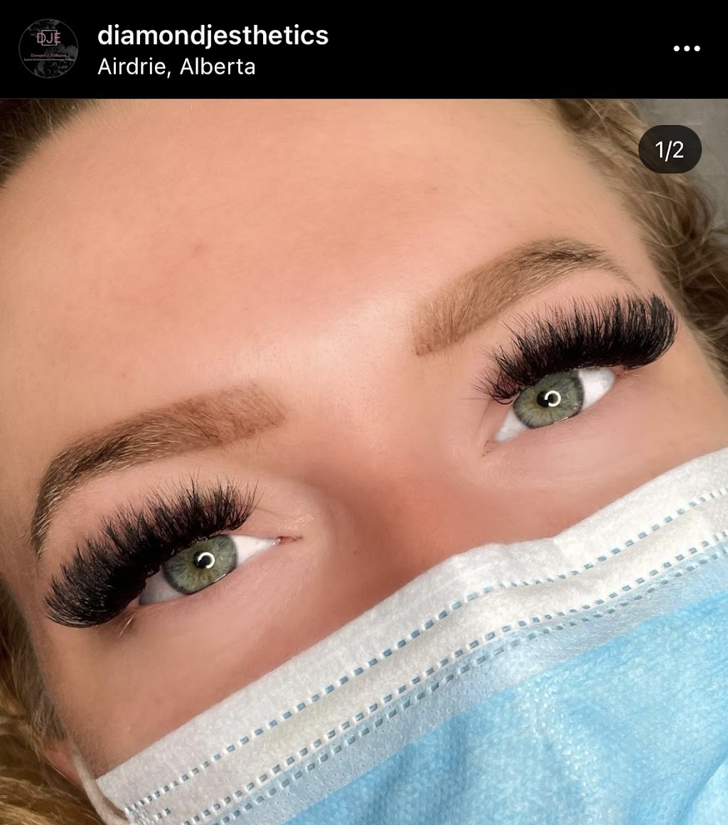 Diamond J Esthetics | Airdrie, AB T4B 0G9, Canada | Phone: (403) 465-0817