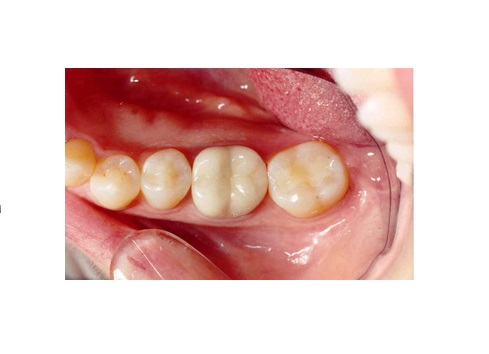 Woodcreek Dental Care | 523 Woodpark Blvd SW #16, Calgary, AB T2W 4J3, Canada | Phone: (403) 238-2872