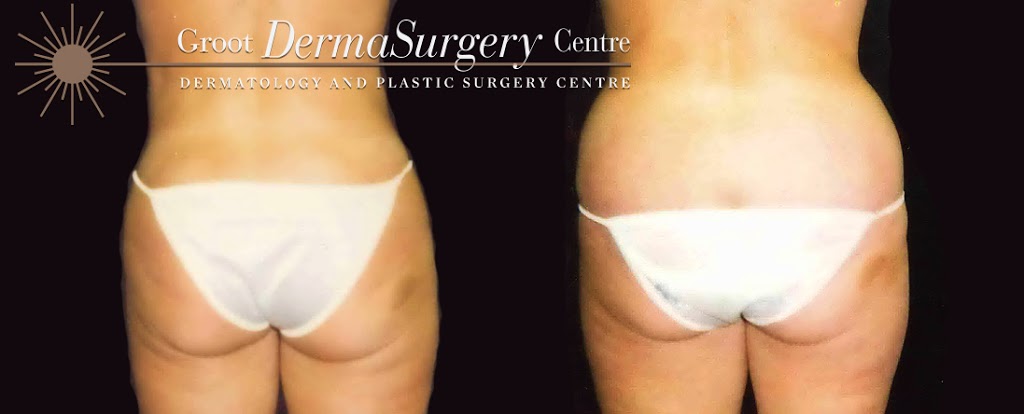 Dr. Thomas Nakatsui - Edmonton Groot DermaSurgery Centre | Suite 200, 9670, 142 Street Northwest, Edmonton, AB T5N 4B2, Canada | Phone: (780) 482-1414