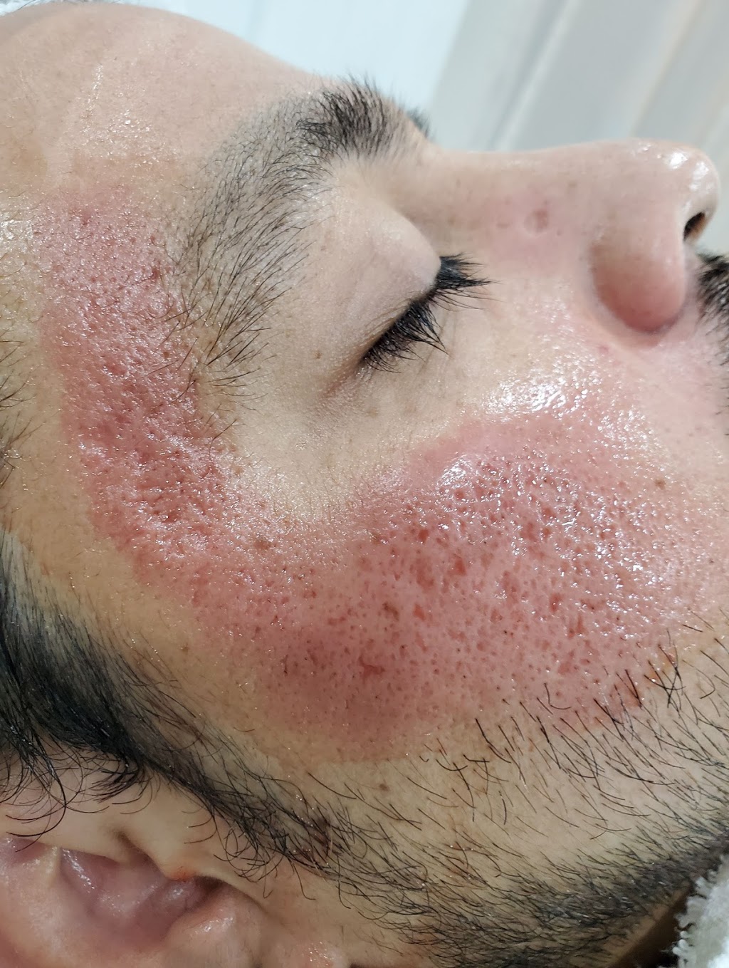 Rejuven Med Spa | 310 Chancellor Dr, Woodbridge, ON L4L 7M1, Canada | Phone: (647) 281-9951