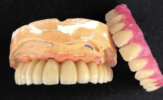 Innovative Dental Laboratories | 1706 Danforth Ave, Toronto, ON M4C 1H8, Canada | Phone: (416) 463-3138
