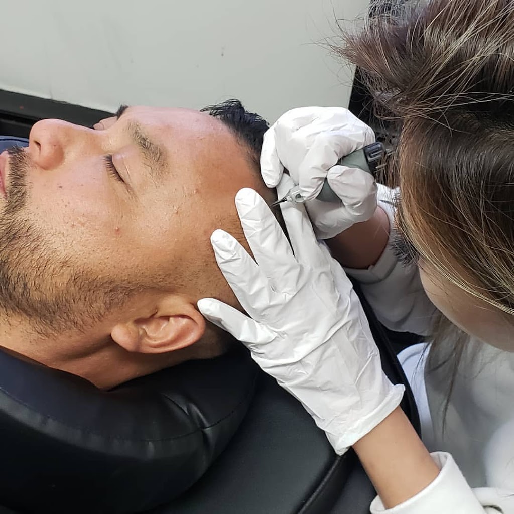 Scalp Micropigmentation by Chronic Ink - Markham | 7381 Kennedy Rd Unit #105, Markham, ON L3R 5B5, Canada | Phone: (905) 305-0311