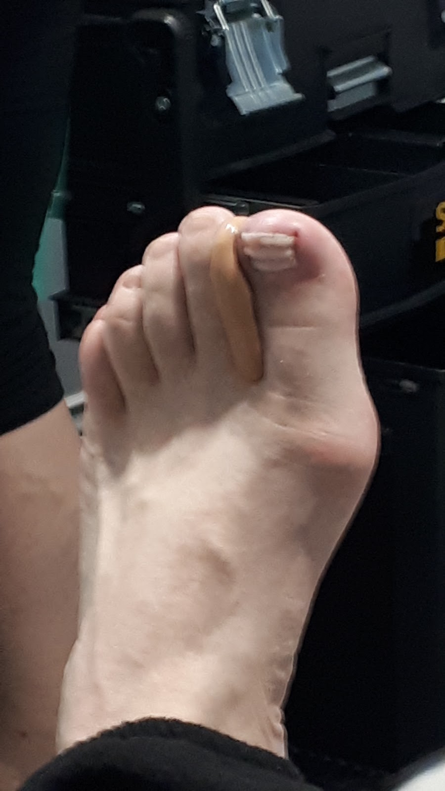 Julia Lewis Footcare | 34 Lyden Dr, Quispamsis, NB E2E 4H3, Canada | Phone: (506) 608-9252