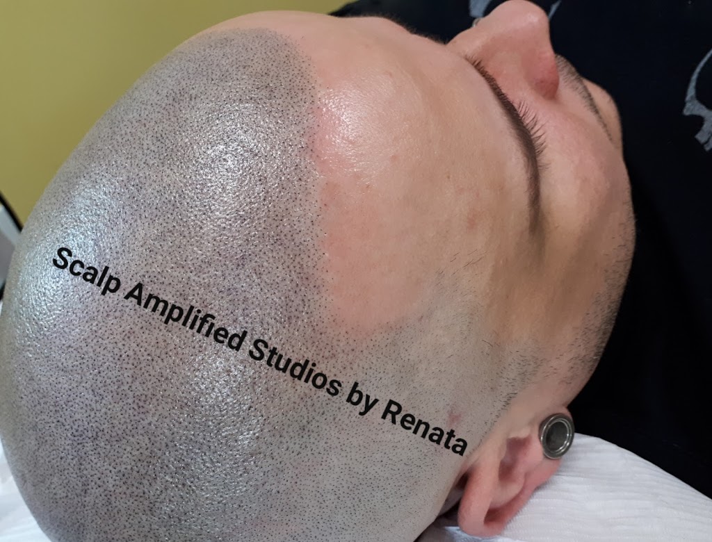 Scalp Amplified Studios / Beauty Amplified Studio | 71 Speers Rd Unit #11, Oakville, ON L6K 0H9, Canada | Phone: (905) 929-9250