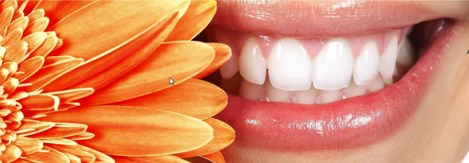 Dental Clinic Dr.Mansouri | 260 Boulevard Saint-Raymond #202, Gatineau, QC J9A 3G7, Canada | Phone: (819) 595-3444