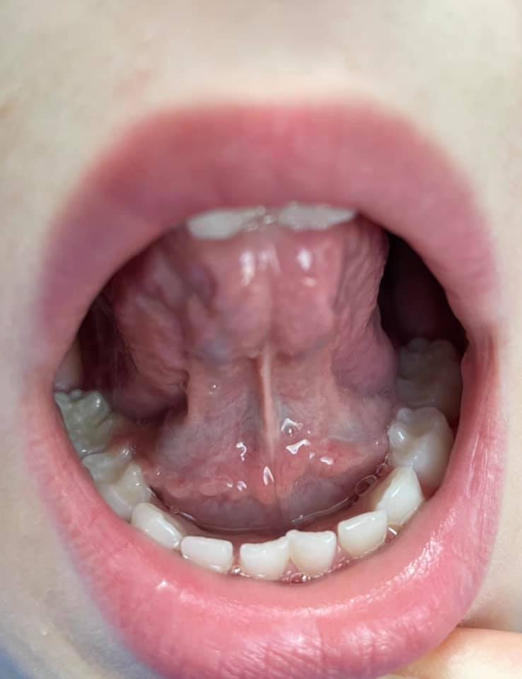 Whites Road Dental Care - Dr Gordon Bunt | 14 Whites Rd, Trenton, ON K8V 5P5, Canada | Phone: (613) 392-4757