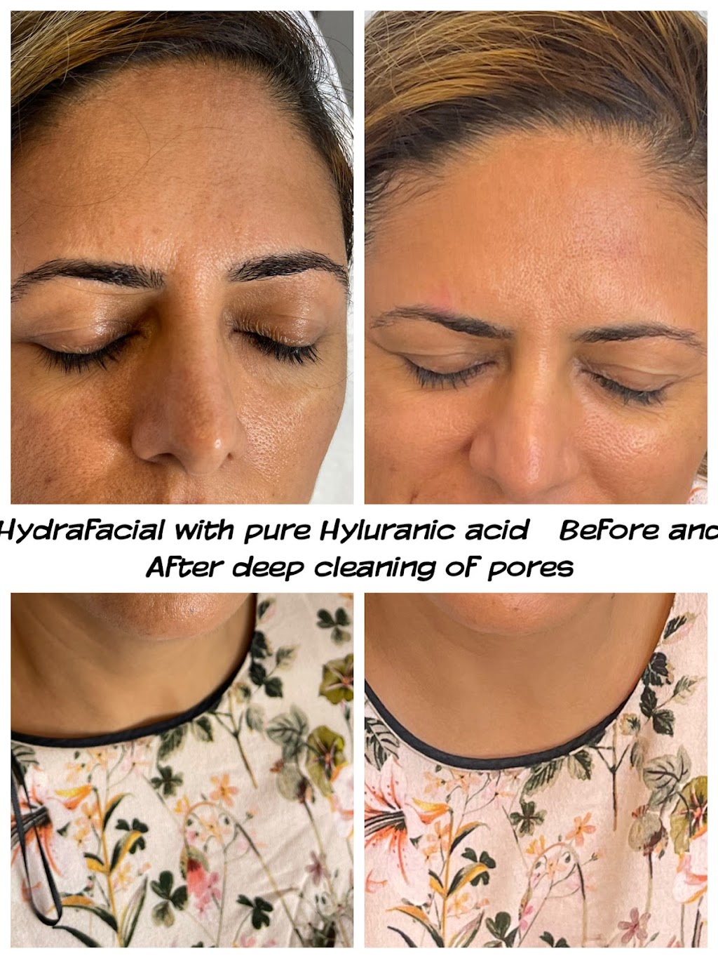 Glow Me Now Aesthetic Lounge & Medi Spa | 1199 Alberni Rd, Woodstock, ON N4T 0H9, Canada | Phone: (647) 767-3349