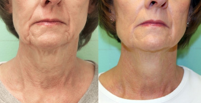 Concept Beauté MC | 2000 Rue des Patriotes bureau 5, Laval, QC H7L 2N8, Canada | Phone: (514) 546-0960