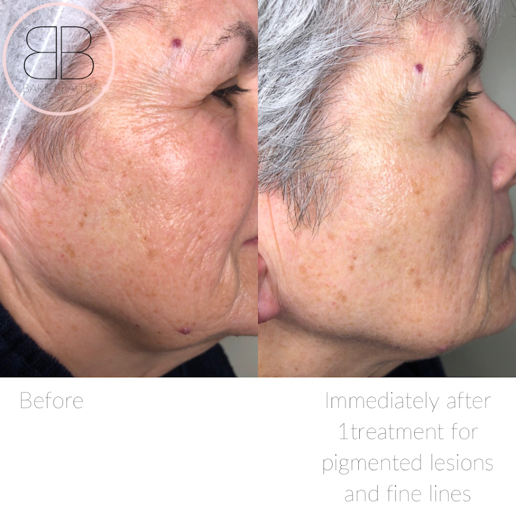Bare Beauty Aesthetics | 976 Shadeland Ave #3, Burlington, ON L7T 2M5, Canada | Phone: (289) 208-3634