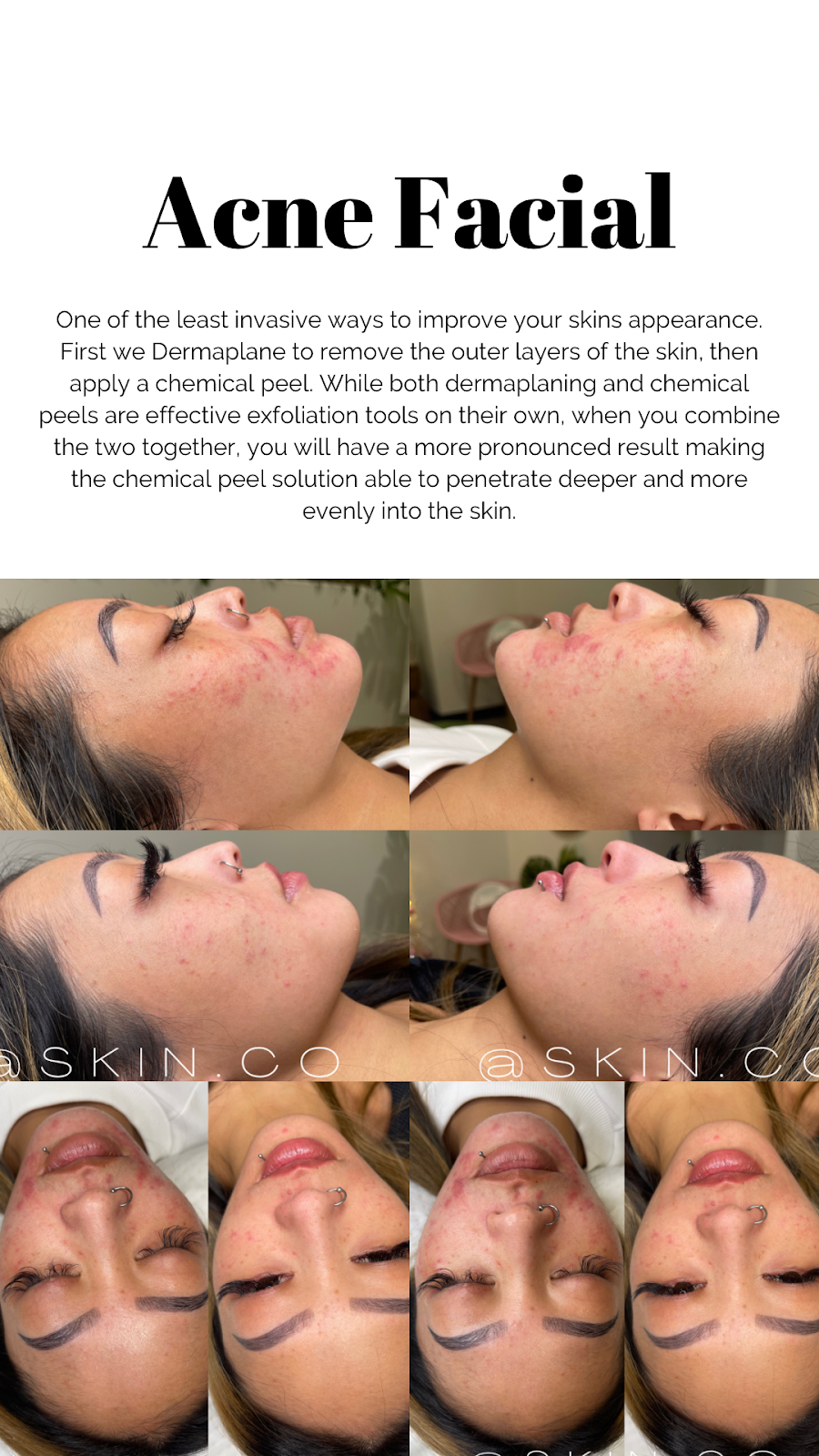 SKIN.CO | 4515 Macleod Trail SW #1008, Calgary, AB T2G 2R5, Canada | Phone: (403) 978-5567
