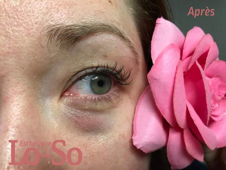 Esthétique Lo-So | 626 Mnt Masson, Sainte-Sophie, QC J5J 1R1, Canada | Phone: (514) 827-1743
