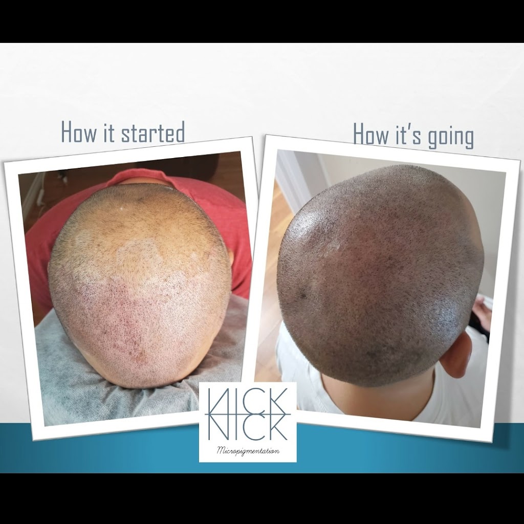 Nick Micropigmentation | 6150 Valley Way Unit A118, Niagara Falls, ON L2E 1X9, Canada | Phone: (289) 321-2183