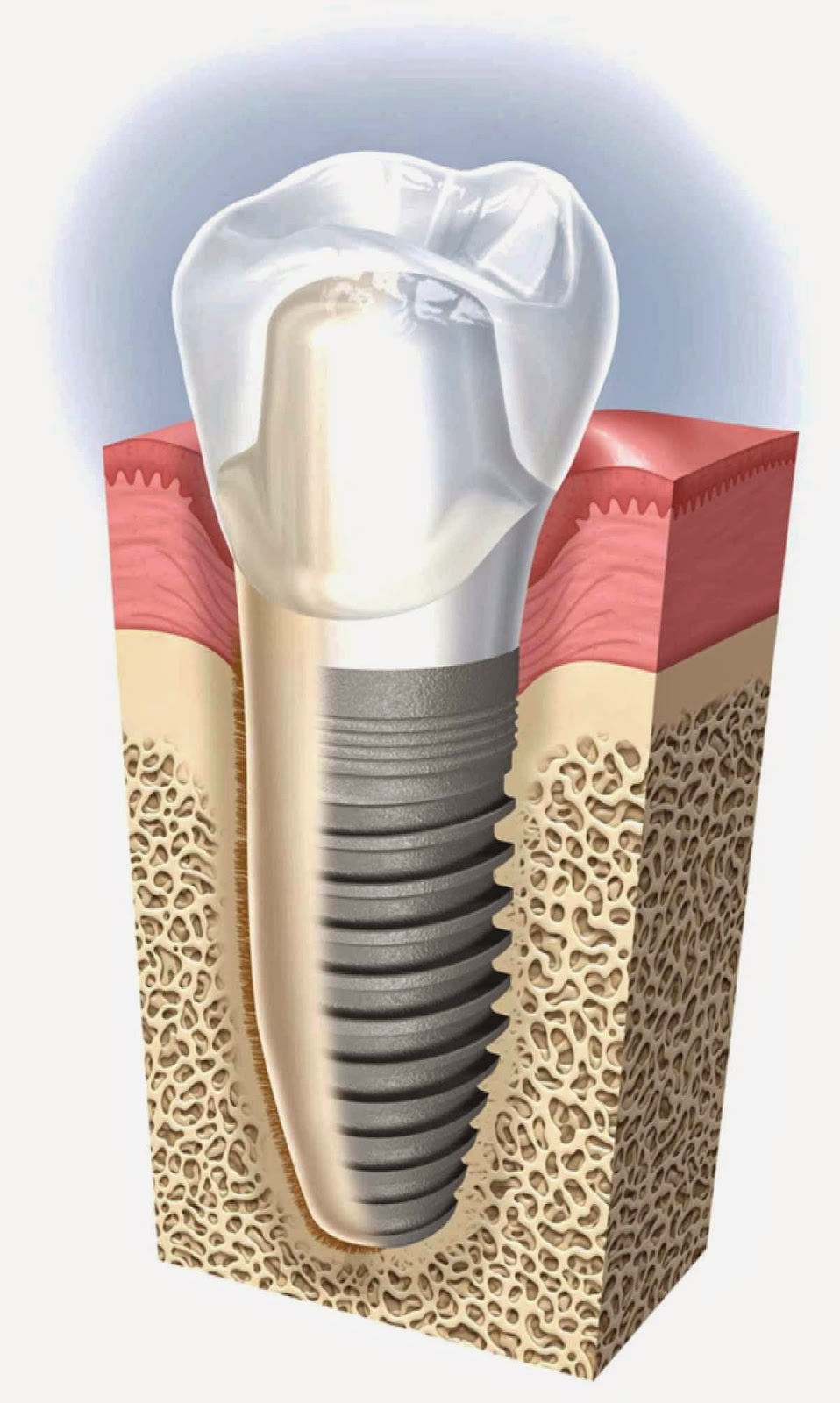 Southwestern Oral & Maxillofacial Surgical Centres | 860 Tecumseh Rd E #200, Windsor, ON N8X 4E7, Canada | Phone: (519) 258-1231
