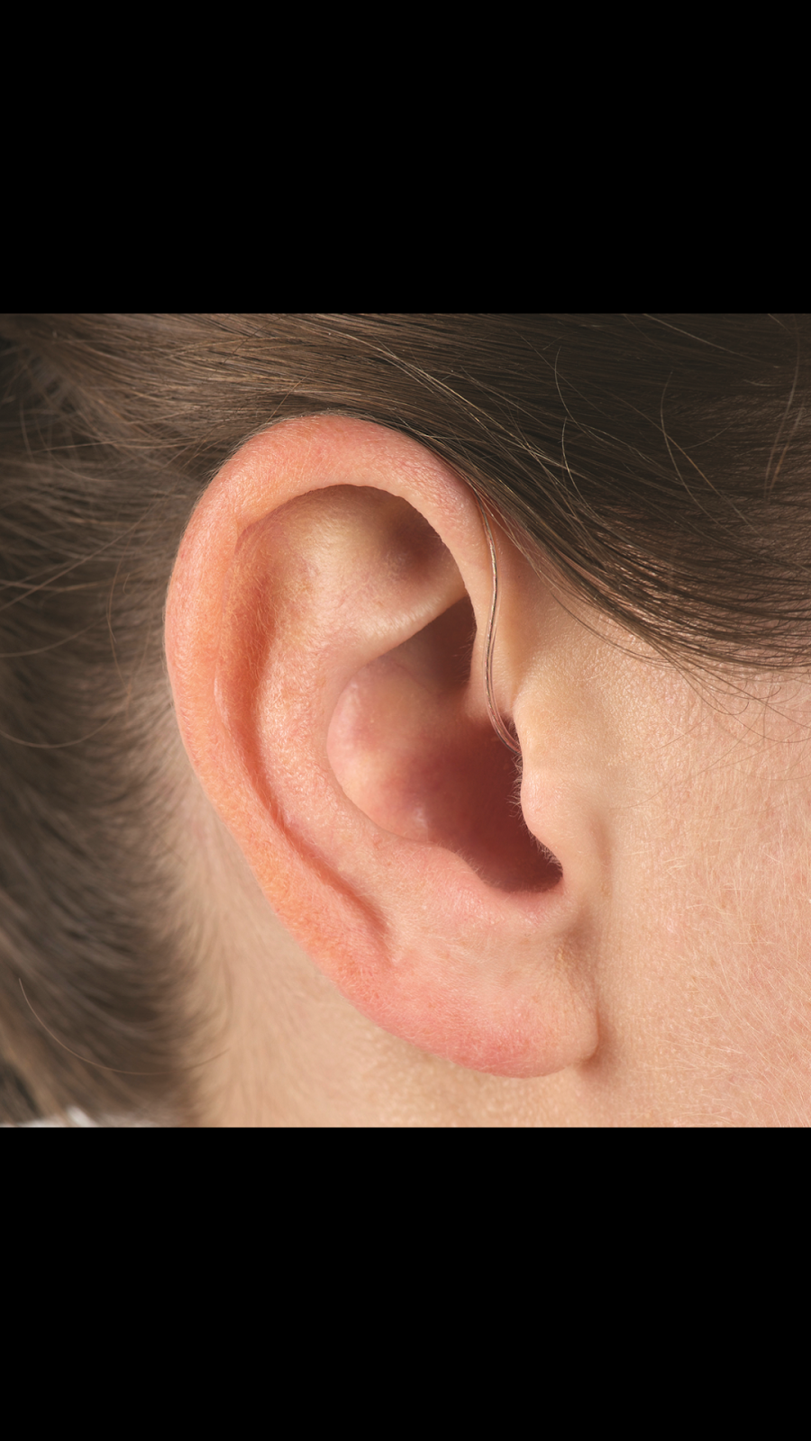 Harmonic Hearing | Inside Appletree Medical, 545 Steeles Ave W, Brampton, ON L6Y 4W5, Canada | Phone: (647) 202-0373