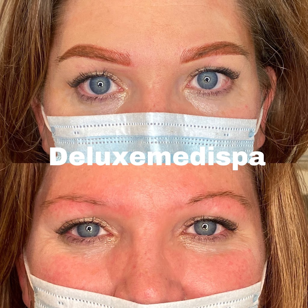 Deluxe Medispa - New Tecumseth Laser Skin Clinic | 10 Catherine St, Loretto, ON L0G 1L0, Canada | Phone: (416) 577-7840