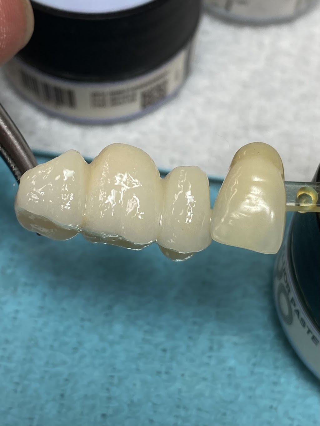 Labworks Dental Services | 10160 Ainsworth Crescent, Richmond, BC V7A 3V4, Canada | Phone: (604) 916-1875