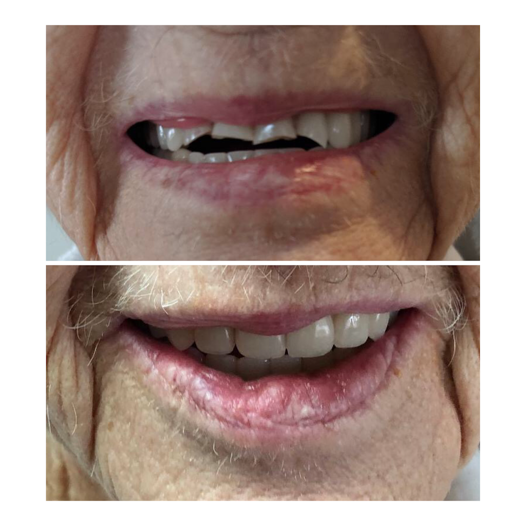 Kasper Denture clinic ltd | 1710 Ellis St Suite 25, Kelowna, BC V1W 3S9, Canada | Phone: (250) 717-3730