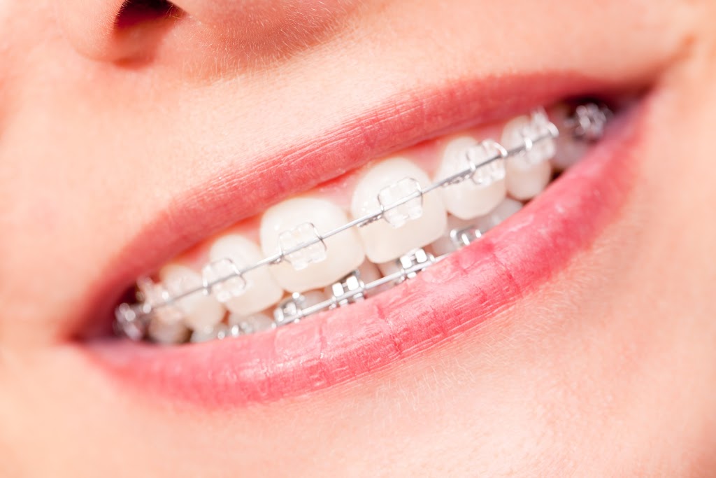 Benbassat Orthodontics | 10 Headdon Gate unit 1a, Richmond Hill, ON L4C 8A2, Canada | Phone: (905) 224-7916