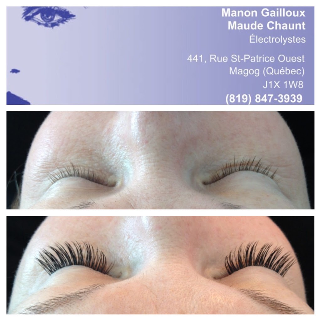 Électrolyse Beauté M A | 1675 Rue Saint-Patrice Est, Magog, QC J1X 3W5, Canada | Phone: (819) 847-3939
