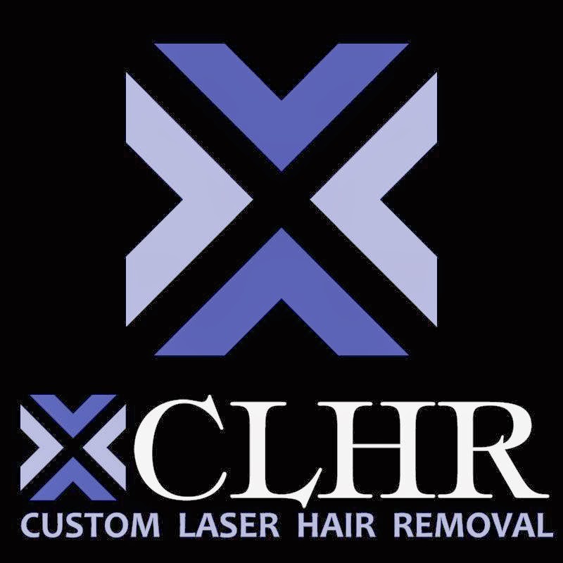 Custom Laser Hair Removal | hair care | 765 Rose Ave, Kelowna, BC V1Y 5K1, Canada | 2508611141 OR +1 250-861-1141