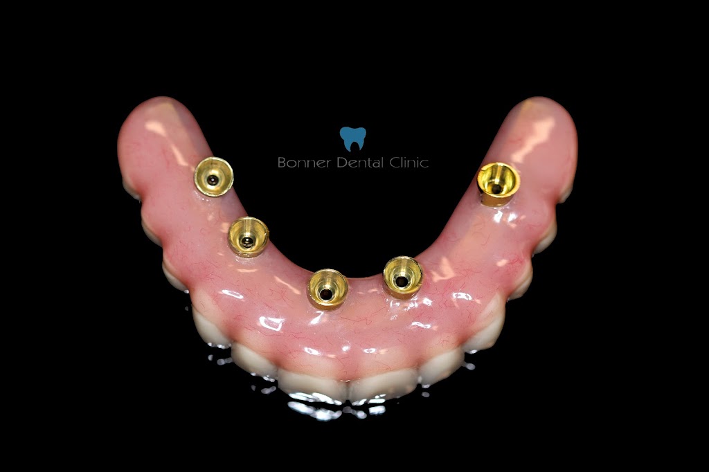 Bonner Dental Clinic | 591 Rothesay Ave, Saint John, NB E2H 2G9, Canada | Phone: (506) 633-1086