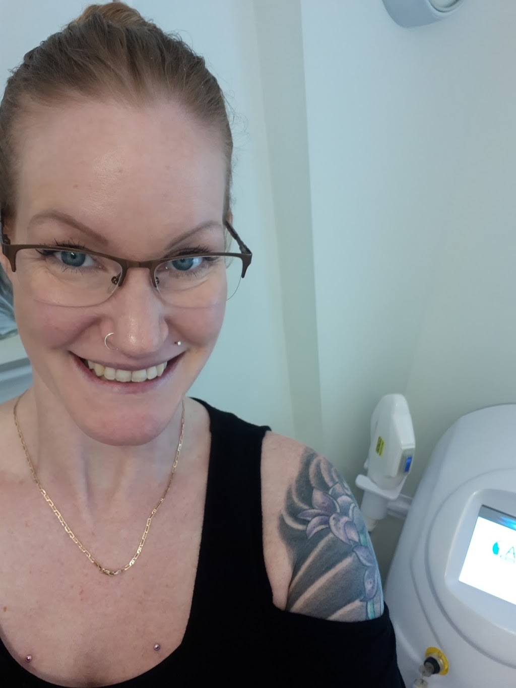 SkinLaser Beauty by Carrie | 168 McGill Dr, Janetville, ON L0B 1K0, Canada | Phone: (705) 341-1909