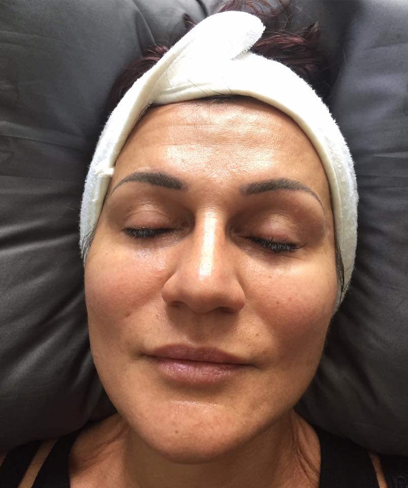 Skinsooolush Medi Spa | 278 Queen St S 2nd Floor, Bolton, ON L7E 4Z5, Canada | Phone: (647) 527-7546