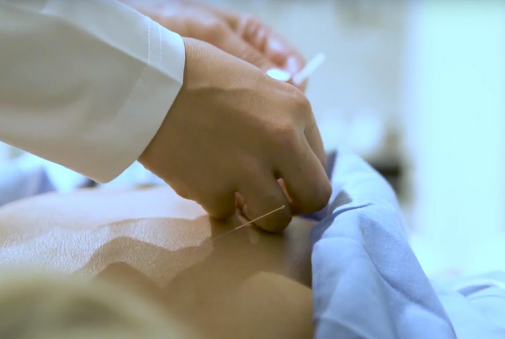 Acucure Acupuncture North Vancouver | 738 Marine Dr, North Vancouver, BC V7M 1H3, Canada | Phone: (778) 200-7543