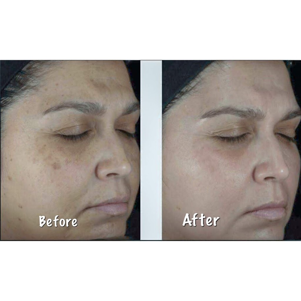 Henz Medispa Saloon | 20 Maritime Ontario Blvd #26, Brampton, ON L6S 0E7, Canada | Phone: (905) 799-6444