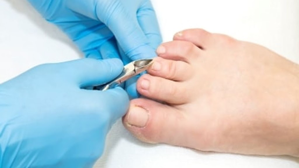 In Stride Foot Care Services | 1830 Mountain Rd, Corner of, Lonsdale Dr Unit D, Moncton, NB E1G 1A7, Canada | Phone: (506) 863-7807