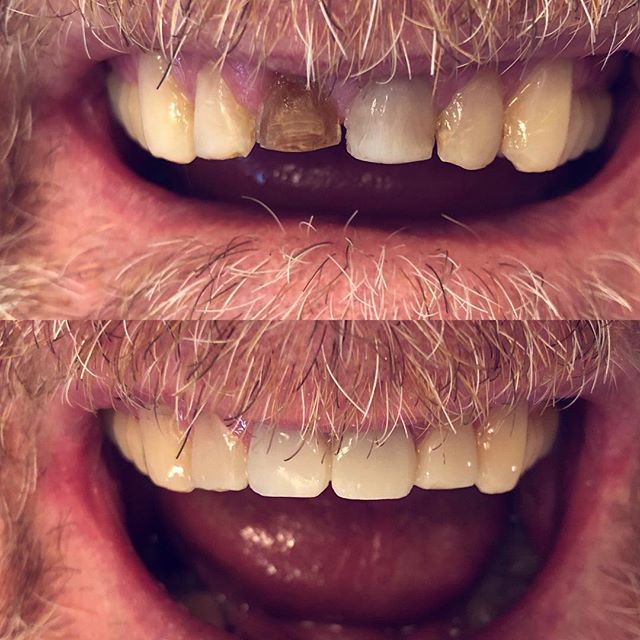Disera Dental Clinic | 30 Disera Dr Unit# 210, Thornhill, ON L4J 0A7, Canada | Phone: (866) 520-3561