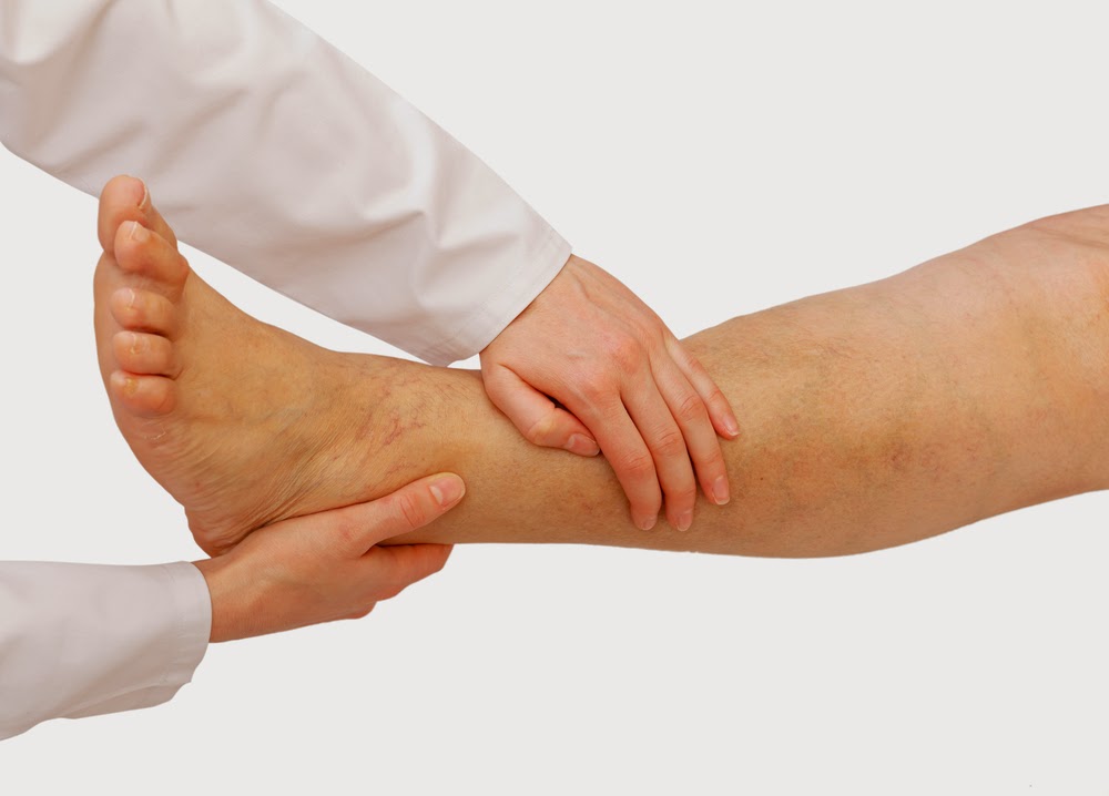 Vaughan Vein Clinic | 57 Centre St, Thornhill, ON L4J 1G2, Canada | Phone: (905) 764-2384