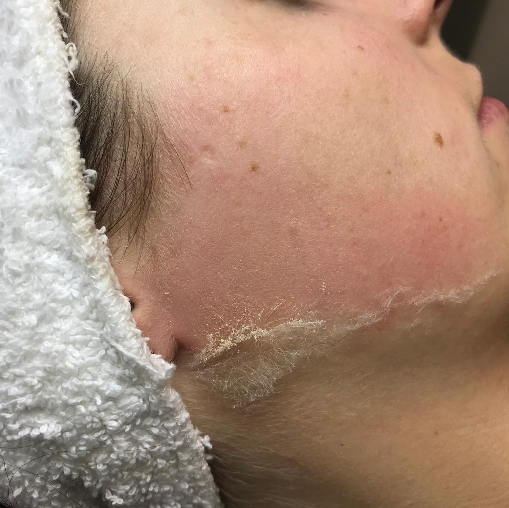 New Day Skin Studio | 771 Vernon Ave #306, Victoria, BC V8X 5A7, Canada | Phone: (250) 590-8931