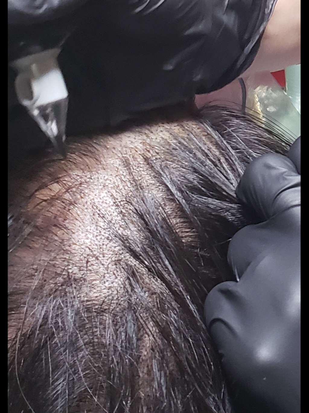 Winnipeg Scalp Micropigmentation | 3 Torrington Rd, Winnipeg, MB R3Y 1B4, Canada | Phone: (204) 999-0229